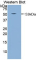 Western Blot; Sample: Recombinant protein.