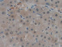 DAB staining on IHC-P; Samples: Human Liver Tissue