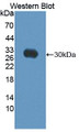 Western Blot; Sample: Recombinant protein.