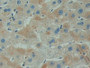 DAB staining on IHC-P; Samples: Human Liver Tissue; Primary Ab: 10µg/ml Rabbit Anti-Human ARL1 Antibody Second Ab: 2µg/mL HRP-Linked Caprine Anti-Rabbit IgG Polyclonal Antibody