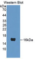 Western Blot; Sample: Recombinant protein.