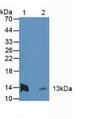 Western Blot; Sample: Lane1: Rat Heart Tissue; Lane2: Mouse Heart Tissue.