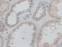 DAB staining on IHC-P; Samples: Human Kidney Tissue.