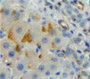 Used in DAB staining on fromalin fixed paraffin-embedded Liver tissue