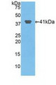 Western Blot; Sample: Recombinant HIST2H2AA3, Human.