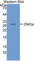 Western Blot; Sample: Recombinant protein.