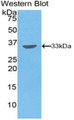 Western Blot; Sample: Recombinant protein.