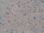 DAB staining on IHC-P; Samples: Human Liver Tissue; Primary Ab: 10µg/ml Rabbit Anti-Human PIM2 Antibody Second Ab: 2µg/mL HRP-Linked Caprine Anti-Rabbit IgG Polyclonal Antibody