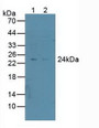 Western Blot; Sample: Lane1: Human A549 Cells; Lane2: Human HepG2 Cells.