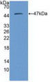 Western Blot; Sample: Recombinant PSMD13, Human.