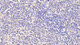 DAB staining on IHC-P; Samples: Human Lymph node Tissue; Primary Ab: 20μg/ml Rabbit Anti-Human zAP720μg/ml Antibody Second Ab: 2µg/mL HRP-Linked Caprine Anti-Rabbit IgG Polyclonal Antibody