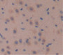 Wingless Type Mmtv Integration Site Family, Member 10A (Wnt10A) Polyclonal Antibody, Cat#CAU21213