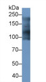 Western Blot; Sample: Porcine Heart lysate; Primary Ab: 1μg/ml Rabbit Anti-Human MYH7B Antibody; Second Ab: 0.2µg/mL HRP-Linked Caprine Anti-Rabbit IgG Polyclonal Antibody;