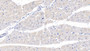 DAB staining on IHC-P; Samples: Human Cardiac Muscle Tissue; Primary Ab: 20µg/ml Rabbit Anti-Human MYH7B Antibody Second Ab: 2µg/mL HRP-Linked Caprine Anti-Rabbit IgG Polyclonal Antibody