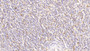 DAB staining on IHC-P; Samples: Human Spleen Tissue; Primary Ab: 20μg/ml Rabbit Anti-Human ATG16L1 Antibody Second Ab: 2µg/mL HRP-Linked Caprine Anti-Rabbit IgG Polyclonal Antibody