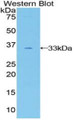 Western Blot; Sample: Recombinant protein.