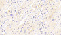 DAB staining on IHC-P; Samples: Human Cardiac Muscle Tissue;  Primary Ab: 20μg/ml Rabbit Anti-Human FNDC5 Antibody Second Ab: 2µg/mL HRP-Linked Caprine Anti-Rabbit IgG Polyclonal Antibody 