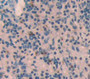 Used in DAB staining on fromalin fixed paraffin- embedded Kidney tissue