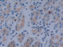 DAB staining on IHC-P; Samples: Human Stomach Tissue; Primary Ab: 10µg/ml Rabbit Anti-Human MACC1 Antibody Second Ab: 2µg/mL HRP-Linked Caprine Anti-Rabbit IgG Polyclonal Antibody