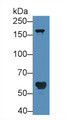 Western Blot; Sample: Human Serum; Primary Ab: 5µg/ml Rabbit Anti-Human POTEG Antibody Second Ab: 0.2µg/mL HRP-Linked Caprine Anti-Rabbit IgG Polyclonal Antibody