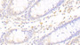 DAB staining on IHC-P; Samples: Human Colon Tissue; Primary Ab: 20μg/ml Rabbit Anti-Human APBB1IP Antibody Second Ab: 2µg/mL HRP-Linked Caprine Anti-Rabbit IgG Polyclonal Antibody