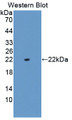 Western Blot; Sample: Recombinant protein.