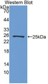 Western Blot; Sample: Recombinant protein.