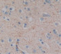 Used in DAB staining on fromalin fixed paraffin- embedded Kidney tissue