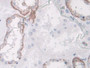 DAB staining on IHC-P; Samples: Human Kidney Tissue; Primary Ab: 10µg/ml Rabbit Anti-Human SPARCL1 Antibody Second Ab: 2µg/mL HRP-Linked Caprine Anti-Rabbit IgG Polyclonal Antibody