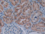 DAB staining on IHC-P; Samples: Human Kidney Tissue