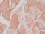 DAB staining on IHC-P; Samples: Rat Skeletal muscle Tissue; Primary Ab: 30µg/ml Rabbit Anti-Rat SIGIRR Antibody Second Ab: 2µg/mL HRP-Linked Caprine Anti-Rabbit IgG Polyclonal Antibody