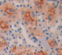 Single Ig Il1 Related Receptor (Sigirr) Polyclonal Antibody, Cat#CAU21325