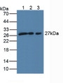 Western Blot; Sample: Lane1: Human MCF-7 Cells; Lane2: Human 293T Cells; Lane3: Human A431 Cells.