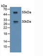 Western Blot; Sample: Mouse Spinal Cord Tissue.