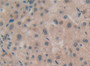 DAB staining on IHC-P; Samples: Human Liver Tissue; Primary Ab: 20µg/ml Rabbit Anti-Human RSPO1 Antibody Second Ab: 2µg/mL HRP-Linked Caprine Anti-Rabbit IgG Polyclonal Antibody