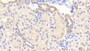 DAB staining on IHC-P; Samples: Human Kidney Tissue;  Primary Ab: 20μg/ml Rabbit Anti-Human REV1 Antibody Second Ab: 2µg/mL HRP-Linked Caprine Anti-Rabbit IgG Polyclonal Antibody 