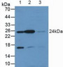 Western Blot; Lane1: Rat Placenta Tissue; Lane2: Rat Brain Tissue; Lane3: Rat Bladder Tissue.