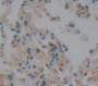 Peroxidasin Homolog (Pxdn) Polyclonal Antibody, Cat#CAU21351