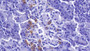 DAB staining on IHC-P; Samples: Human Pancreas Tissue; Primary Ab: 10µg/ml Rabbit Anti-Human PDLIM1 Antibody Second Ab: 2µg/mL HRP-Linked Caprine Anti-Rabbit IgG Polyclonal Antibody