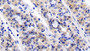 DAB staining on IHC-P; Sample: Porcine Stomach Tissue; Primary Ab: 20μg/ml Rabbit Anti-Human RPS6Kb1 Antibody Second Ab: 2µg/mL HRP-Linked Caprine Anti-Rabbit IgG Polyclonal Antibody