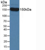 Western Blot; Sample: Mouse Serum.