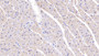 DAB staining on IHC-P; Samples: Human Cardiac Muscle Tissue; Primary Ab: 10µg/ml Rabbit Anti-Human SEMA5B Antibody Second Ab: 2µg/mL HRP-Linked Caprine Anti-Rabbit IgG Polyclonal Antibody