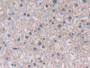 DAB staining on IHC-P; Samples: Human Liver Tissue; Primary Ab: 30µg/ml Rabbit Anti-Human SEMA3E Antibody Second Ab: 2µg/mL HRP-Linked Caprine Anti-Rabbit IgG Polyclonal Antibody