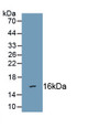 Semaphorin 3C (SEMA3C) Polyclonal Antibody, CAU21385