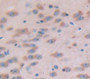 Semaphorin 3A (Sema3A) Polyclonal Antibody, Cat#CAU21387