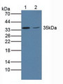 Western Blot; Sample: Lane1: Porcine Brain Tissue ; Lane2: Human HeLa Cells.