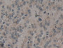 DAB staining on fromalin fixed paraffin- embedded kidney tissue)