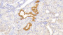 DAB staining on IHC-P; Samples: Human Kidney Tissue;  Primary Ab: 20μg/ml Rabbit Anti-Human WNT2B Antibody Second Ab: 2µg/mL HRP-Linked Caprine Anti-Rabbit IgG Polyclonal Antibody 