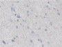 DAB staining on IHC-P; Samples: Human Glioma Tissue; Primary Ab: 30µg/ml Rabbit Anti-Human MX2 Antibody Second Ab: 2µg/mL HRP-Linked Caprine Anti-Rabbit IgG Polyclonal Antibody