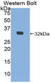 Western Blot; Sample: Recombinant protein.